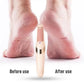 Pedi Electronic Pedicure Tool, File & Callous Remover